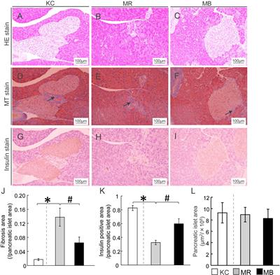 Development of the Diabetic Kidney Disease Mouse Model Culturing Embryos in α-Minimum Essential Medium In Vitro, and Feeding Barley Diet Attenuated the Pathology